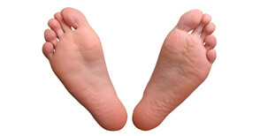 Flat-Foot